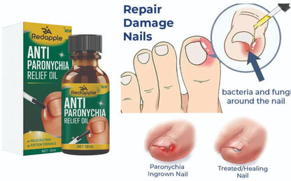 Anti Paronychia Relief Oil
